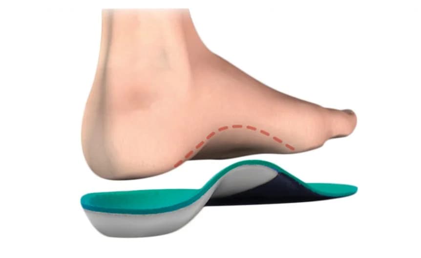 When Should I Update My Orthotics?