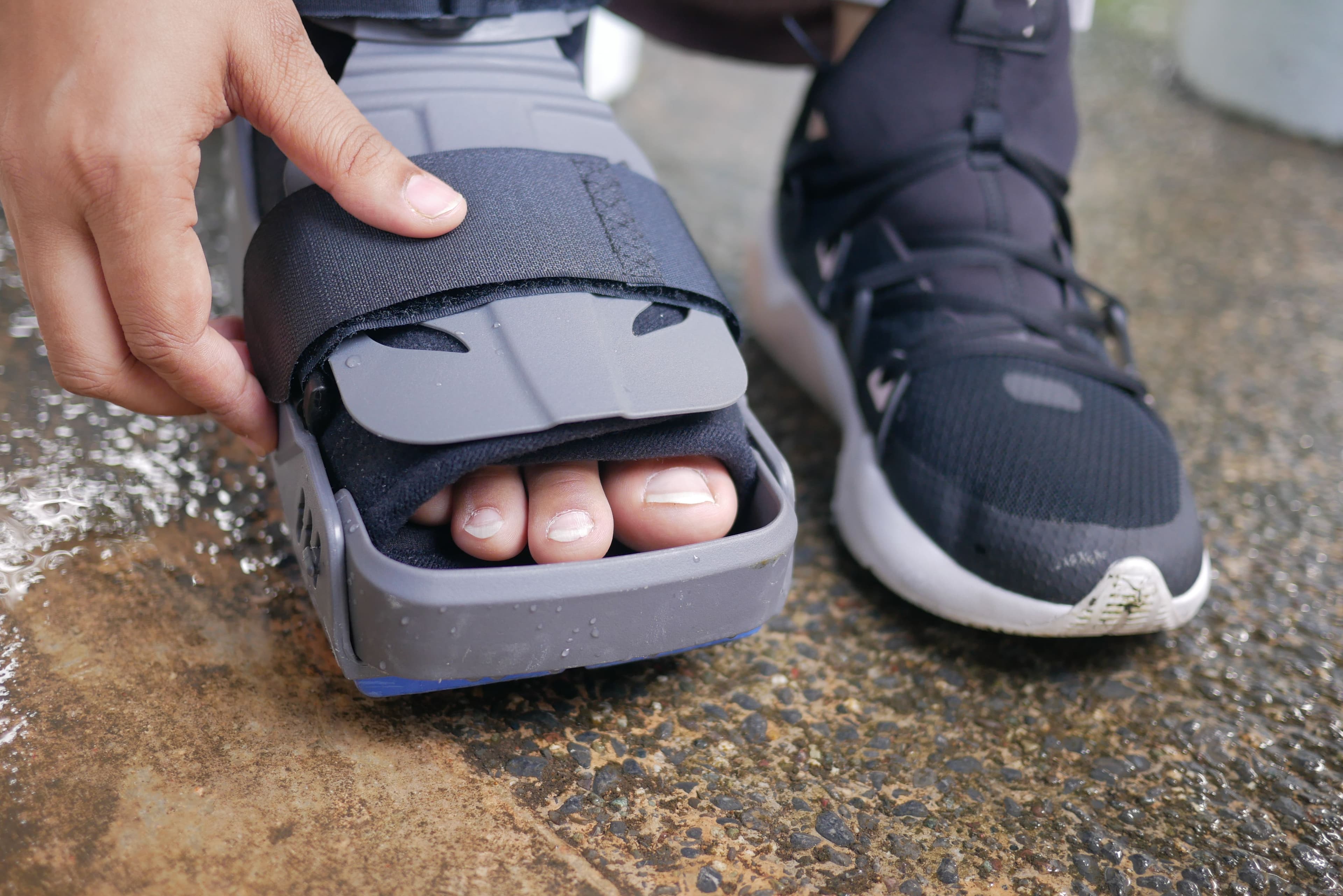 Why are my toenails unsightly? - Podiatry insights from FALL Clinic Perth